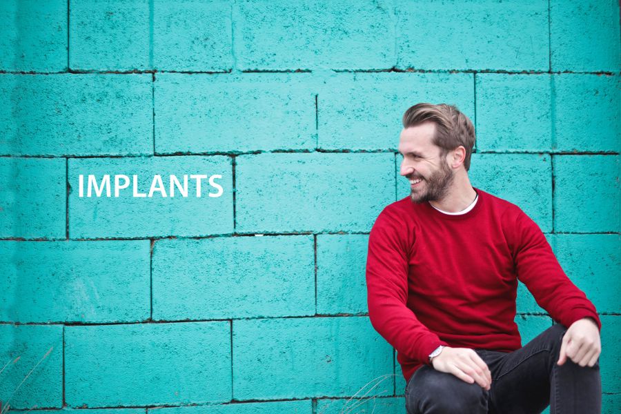 Everything You Need to Know About Dental Implants 